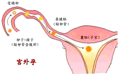 输卵管发育不良或功能异常,慢性输卵管炎,子宫肌瘤,卵巢肿瘤等有关系