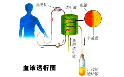 糖尿病的人透析是什么原理_什么是糖尿病图片