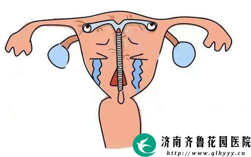 上环后出血是怎么回事 正常吗