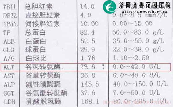 体检发现谷丙转氨酶偏高是得肝病了吗